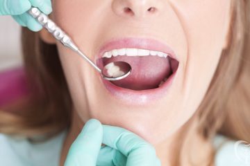 Dental Cleanings in Lynchburg