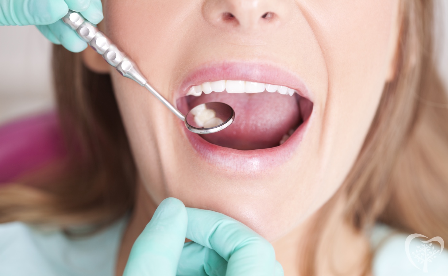 Dental Cleanings in Lynchburg